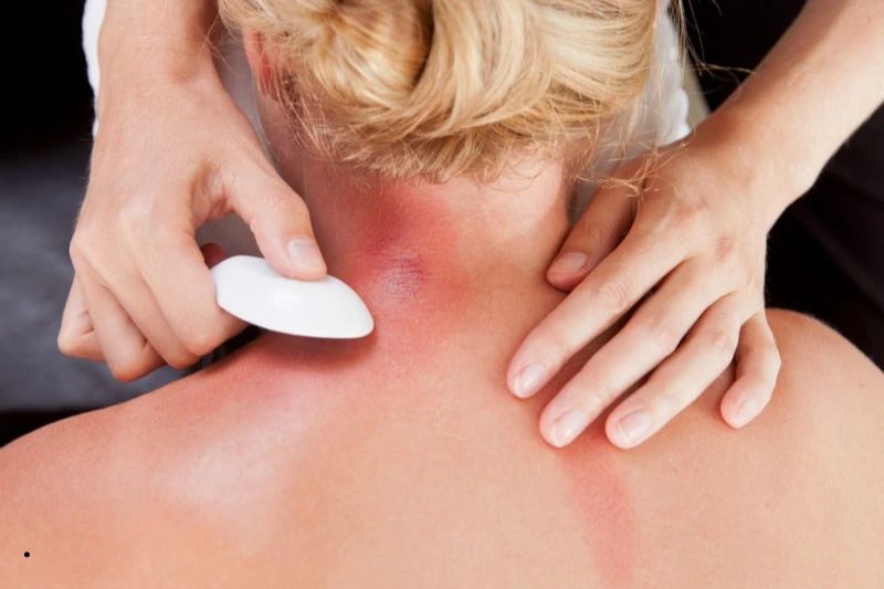 Ưu nhược điểm của phương pháp cạo gió giác hơi
