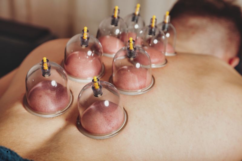 Cạo gió giác hơi được hiểu như thế nào